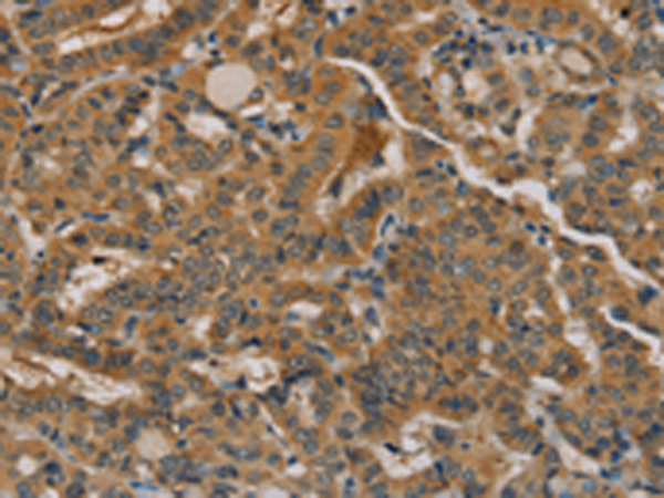 Rabbit Polyclonal Antibody to NANOS2
