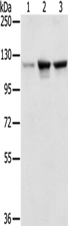 Rabbit Polyclonal Antibody to NAT10