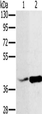 Rabbit Polyclonal Antibody to NDUFA10