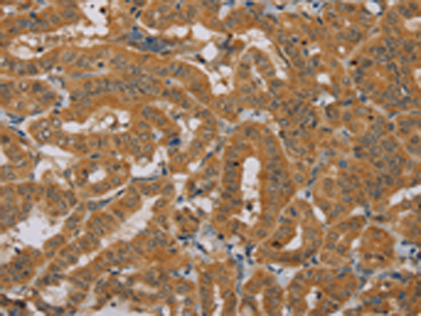 Rabbit Polyclonal Antibody to NDUFAF1