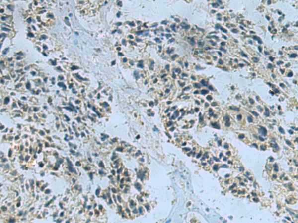 Rabbit Polyclonal Antibody to NDUFA2