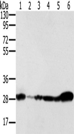 Rabbit Polyclonal Antibody to NDUFS3