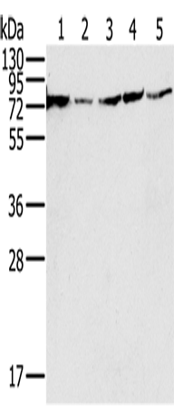 Rabbit Polyclonal Antibody to NDUFS1
