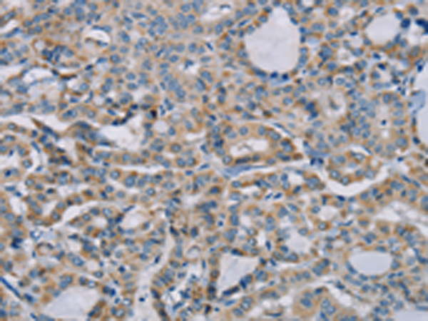 Rabbit Polyclonal Antibody to NDUFS7
