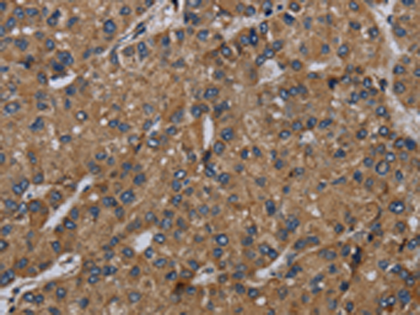 Rabbit Polyclonal Antibody to NDUFS6