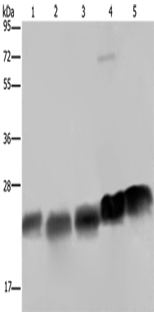 Rabbit Polyclonal Antibody to NDUFS8