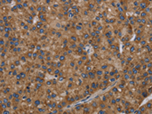 Rabbit Polyclonal Antibody to NECTIN2