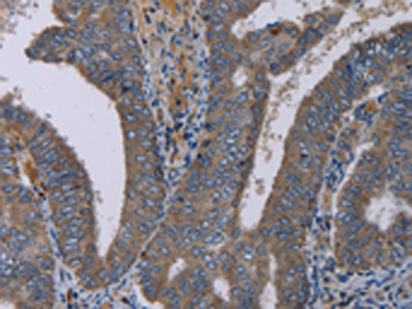 Rabbit Polyclonal Antibody to NECTIN4