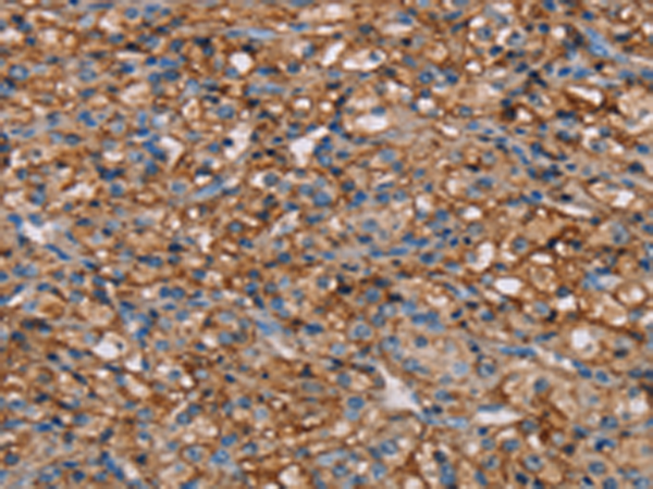 Rabbit Polyclonal Antibody to NEDD4L