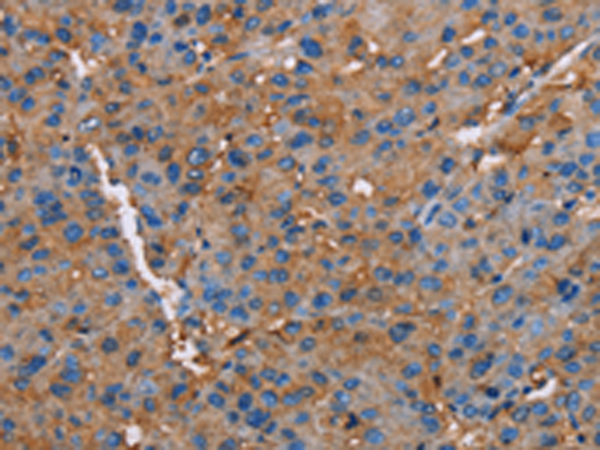 Rabbit Polyclonal Antibody to NLGN1