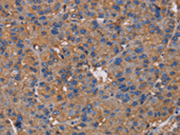Rabbit Polyclonal Antibody to NCSTN