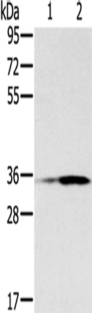 Rabbit Polyclonal Antibody to NIT1