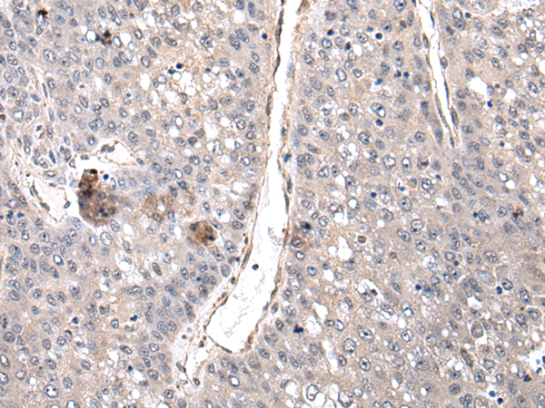 Rabbit Polyclonal Antibody to NKX2-5