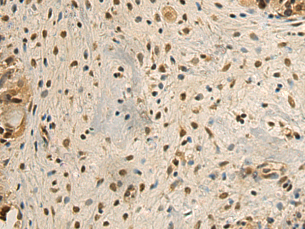 Rabbit Polyclonal Antibody to NRIP1
