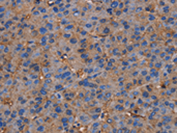 Rabbit Polyclonal Antibody to NRIP3