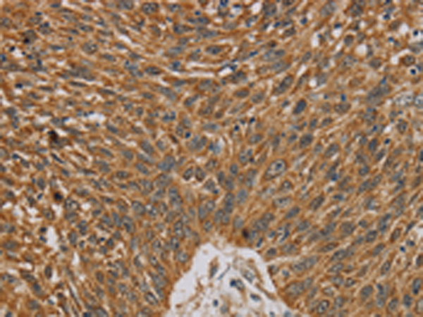 Rabbit Polyclonal Antibody to NDEL1