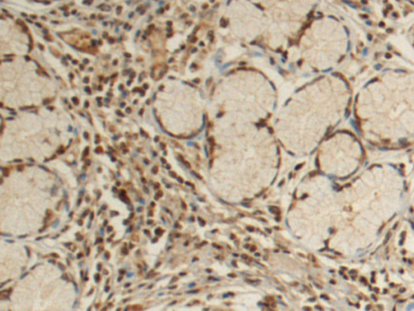 Rabbit Polyclonal Antibody to NUPR1