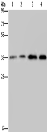 Rabbit Polyclonal Antibody to OCIAD1