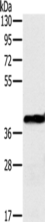 Rabbit Polyclonal Antibody to OTC
