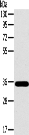Rabbit Polyclonal Antibody to OTUB1