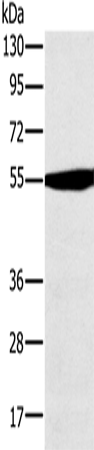 Rabbit Polyclonal Antibody to OXCT1