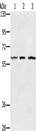 Rabbit Polyclonal Antibody to OXSR1