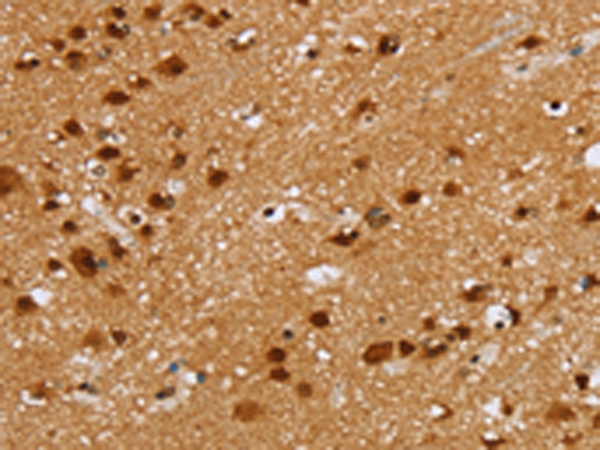 Rabbit Polyclonal Antibody to ZMAT3