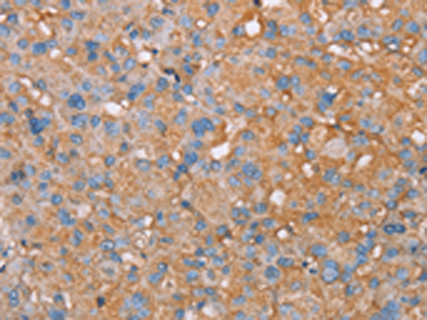 Rabbit Polyclonal Antibody to PAGE5