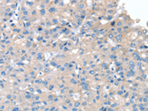 Rabbit Polyclonal Antibody to SERPINB2