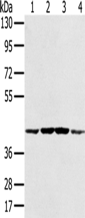 Rabbit Polyclonal Antibody to PAICS