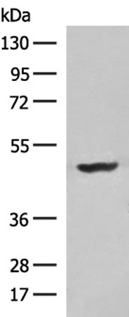 Rabbit Polyclonal Antibody to PNLIP