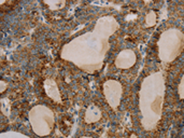 Rabbit Polyclonal Antibody to PARL