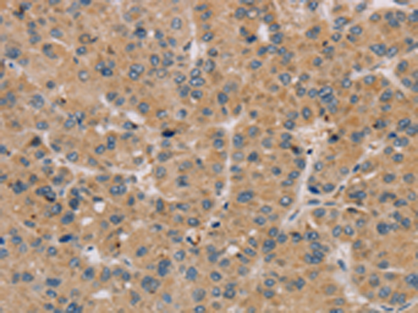 Rabbit Polyclonal Antibody to PARP3