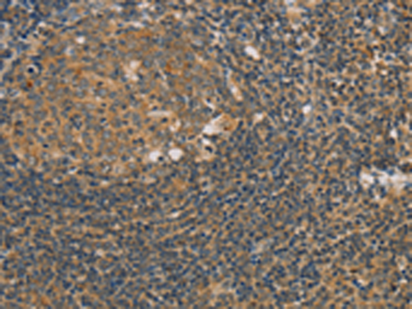Rabbit Polyclonal Antibody to PARP11