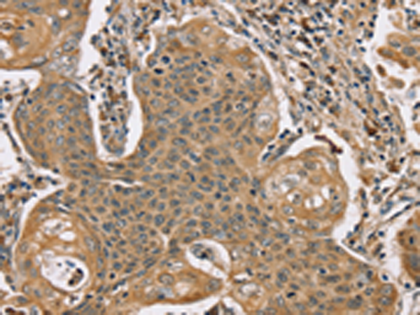 Rabbit Polyclonal Antibody to SCGB2A1