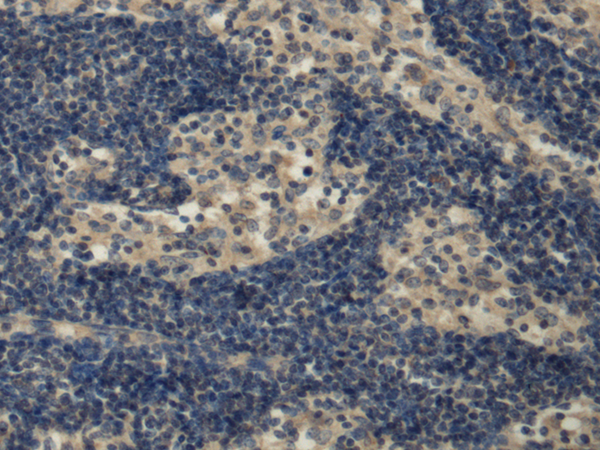 Rabbit Polyclonal Antibody to PDGFD