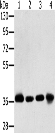 Rabbit Polyclonal Antibody to PDLIM1