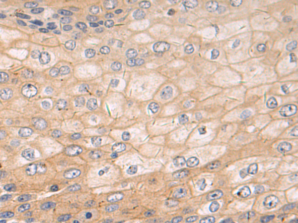 Rabbit Polyclonal Antibody to PDLIM2