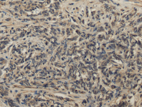 Rabbit Polyclonal Antibody to PDLIM5