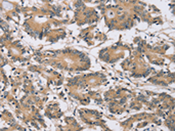 Rabbit Polyclonal Antibody to PDLIM7