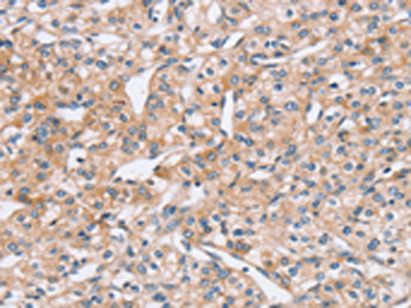 Rabbit Polyclonal Antibody to PEA15