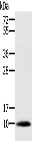 Rabbit Polyclonal Antibody to MSMB