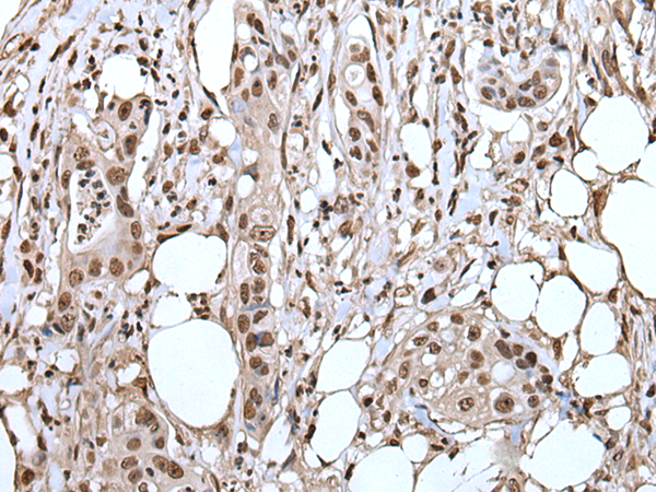 Rabbit Polyclonal Antibody to ANP32A