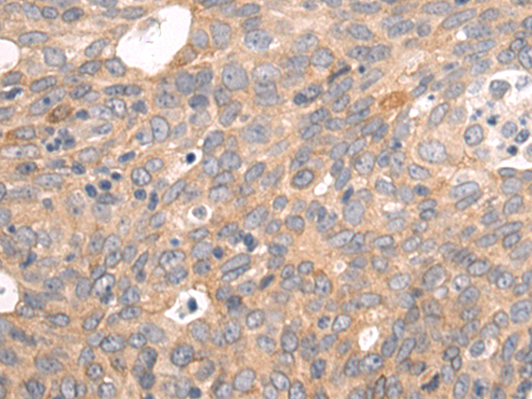 Rabbit Polyclonal Antibody to EGLN1