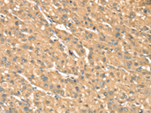 Rabbit Polyclonal Antibody to PHKB