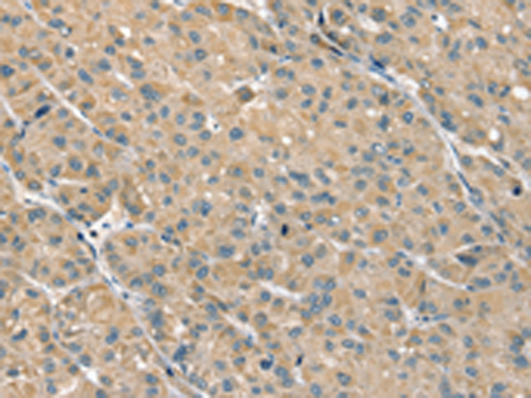 Rabbit Polyclonal Antibody to PHLPP1