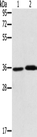 Rabbit Polyclonal Antibody to PHYH