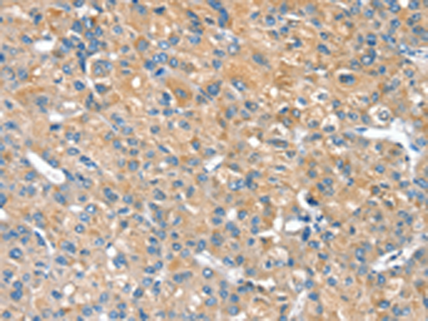 Rabbit Polyclonal Antibody to PILRB