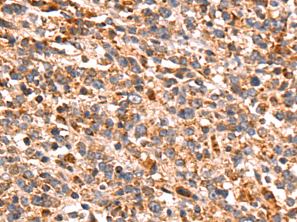 Rabbit Polyclonal Antibody to PRKACB