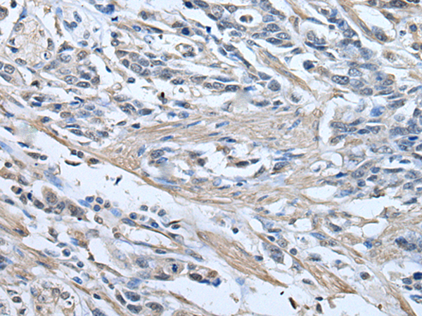 Rabbit Polyclonal Antibody to PRKAR2A